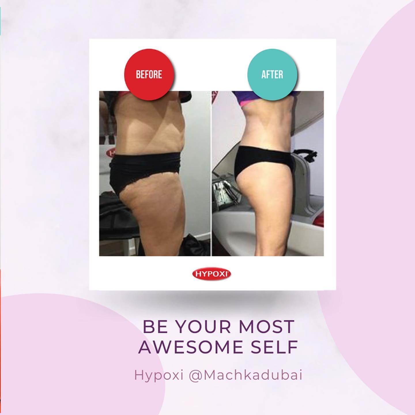 machkadubai_278733752_315493270726877_3093137328454134857_n