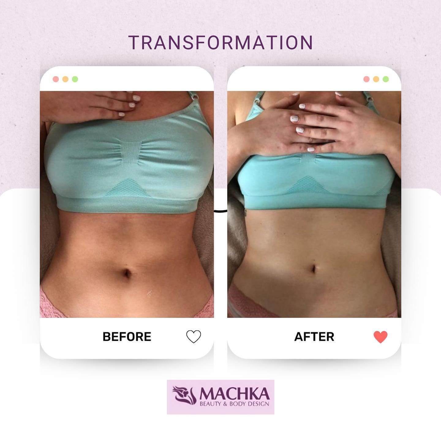 machkadubai_353361343_1439583336829654_8710193154062215716_n