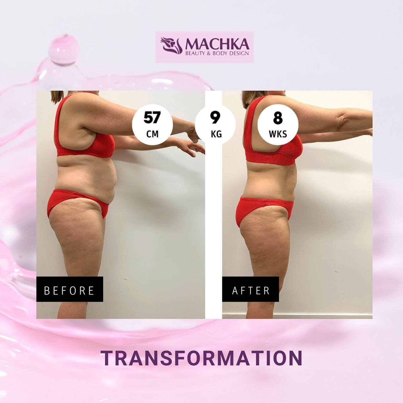 machkadubai_360032373_2003748929959527_6847383840794215541_n